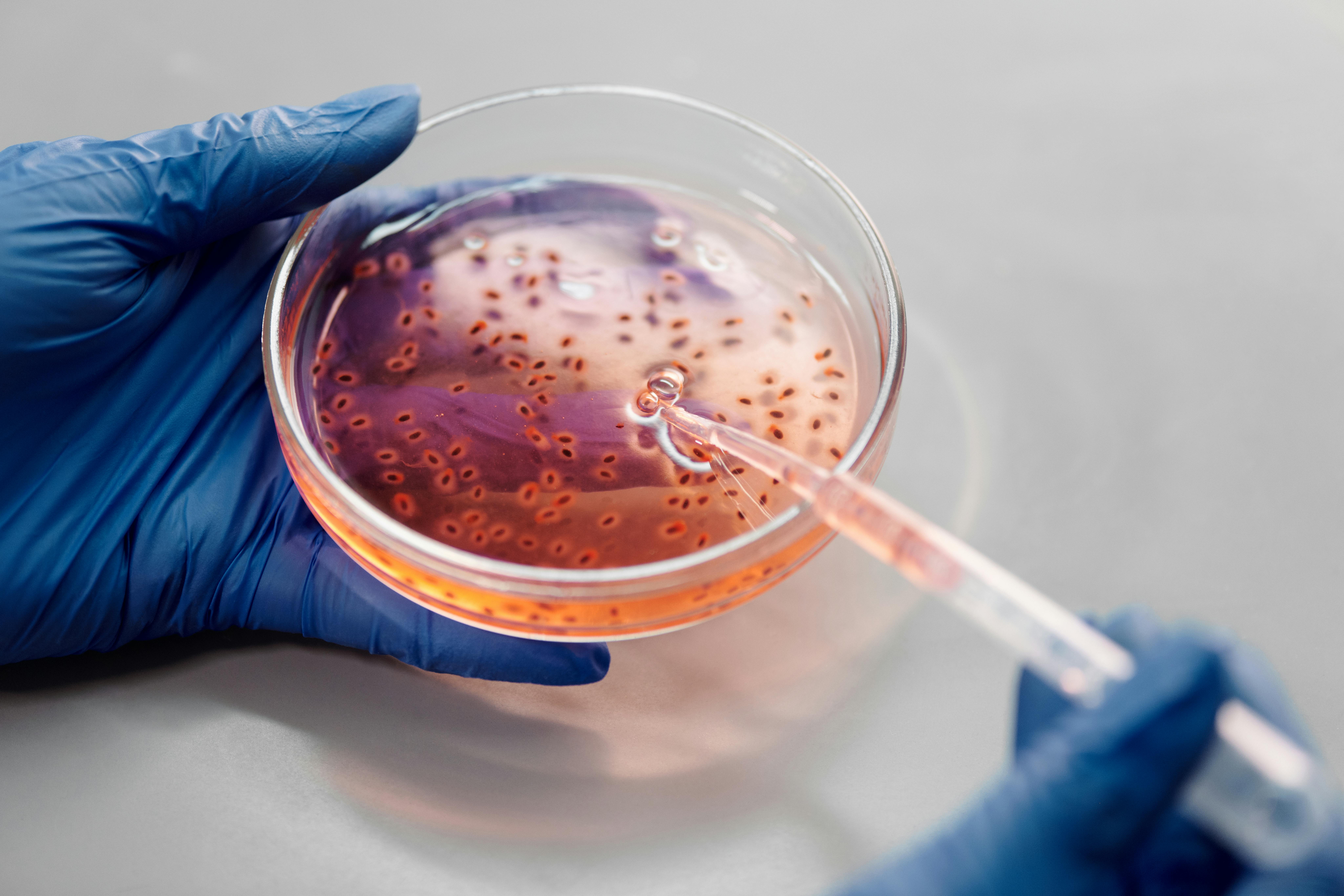 Bacterial control